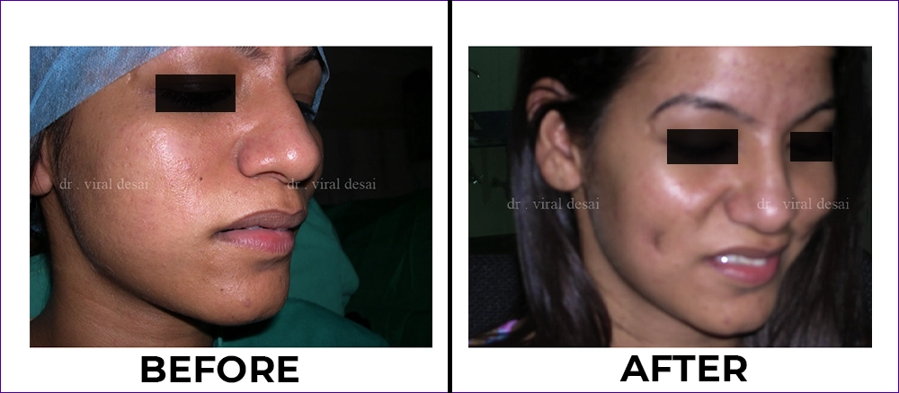 BEFORE AND AFTER TREATMENT IMAGES<br />
