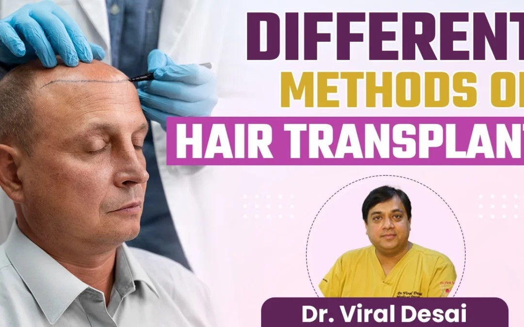 Understanding Hair Transplants - Unveiling the Techniques