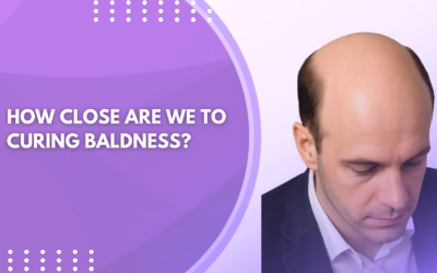 How Close Are We to Curing Baldness?