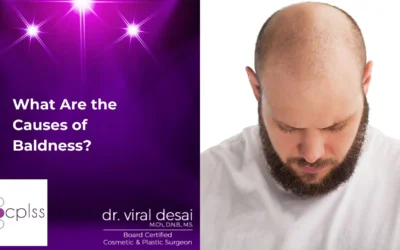 What Are the Causes of Baldness?