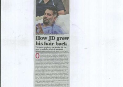 JD Majethiya hair transplant - Mumbai Mirror