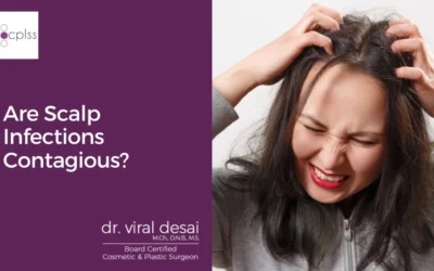 Are Scalp Fungal Infections Contagious?