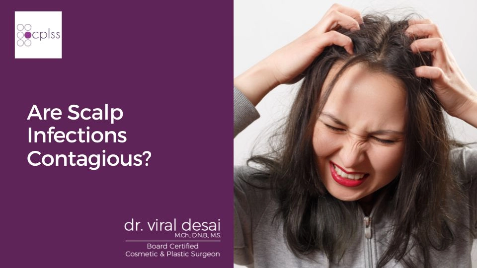 Are Scalp Fungal Infections Contagious?