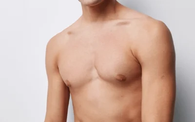 Can Gynecomastia Come Back After Surgery?