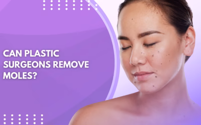 Can Plastic Surgeons Remove Moles?