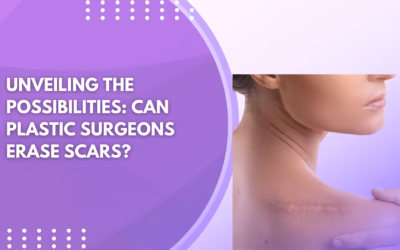 Unveiling the Possibilities: Can Plastic Surgeons Erase Scars?