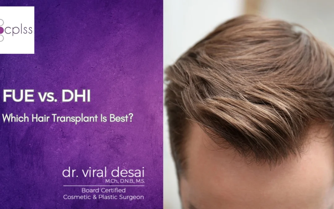 Which Hair Transplant Is Best FUE Or DHI?