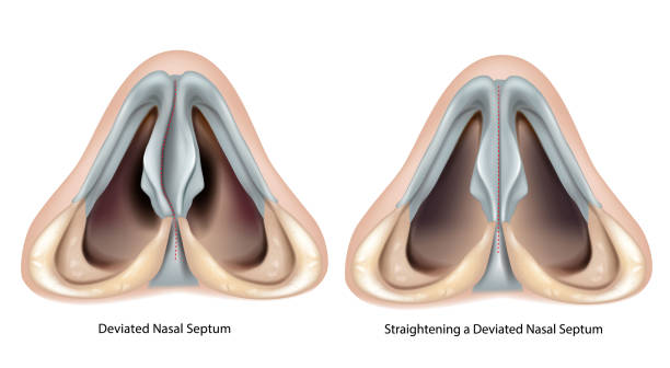 Correcting Deviation