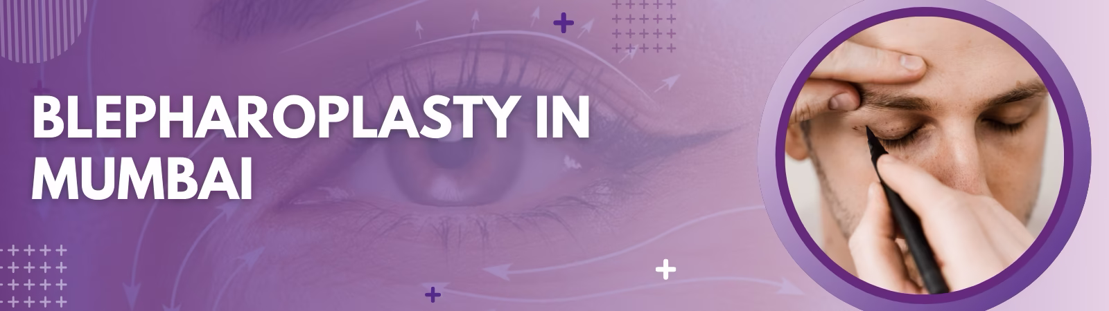 Eyelid Surgery in Mumbai