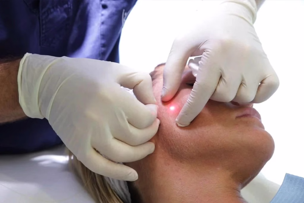 What to Expect During and After the Procedure