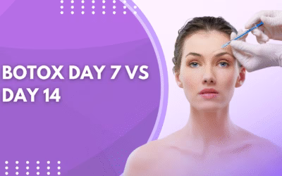 Botox Day 7 Vs Day 14