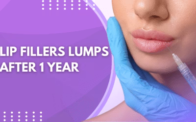 Lip Filler Lumps After 1 Year