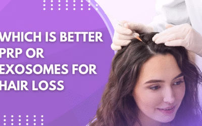 Which is Better PRP vs Exosomes for Hair Loss?