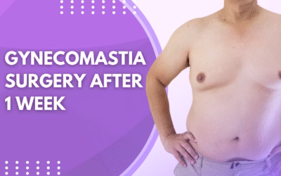 Gynecomastia Surgery After 1 Week