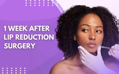 1 Week After Lip Reduction Surgery