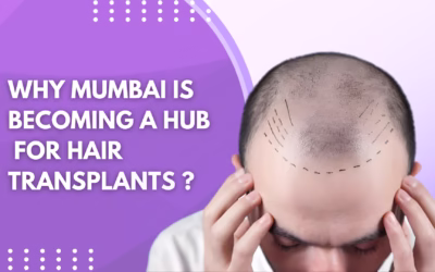 Why Mumbai Is Becoming a Hub for Hair Transplants