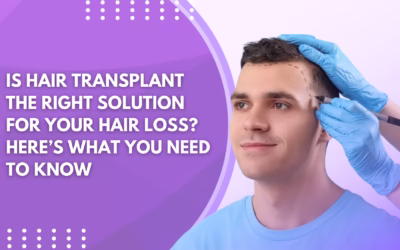 Is Hair Transplant the Right Solution for Your Hair Loss? Here’s What You Need to Know