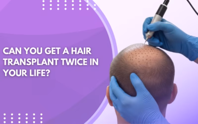 Can You Get a Hair Transplant Twice in Your Life ?