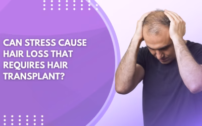 Can Stress Cause Hair Loss That Requires Hair Transplant?