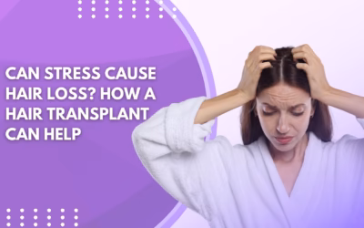 Can Stress Cause Hair Loss? How a Hair Transplant Can Help