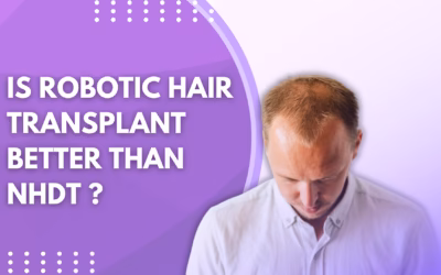 Is Robotic Hair Transplant Better Than Manual NHDT Method?