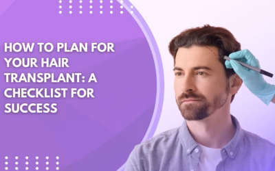 How to Plan for Your Hair Transplant: A Checklist for Success