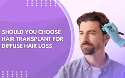 Should You Choose Hair Transplant for Diffuse Hair Loss or Pattern Baldness?