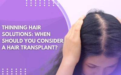 Thinning Hair Solutions: When to Get a Hair Transplant?