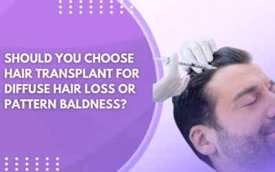 Should You Choose Hair Transplant for Diffuse Hair Loss or Pattern Baldness?