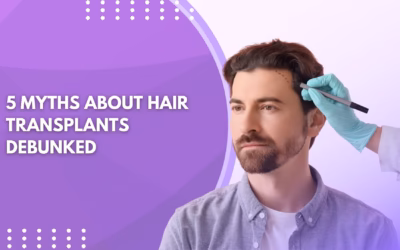 5 Myths About Hair Transplants Debunked
