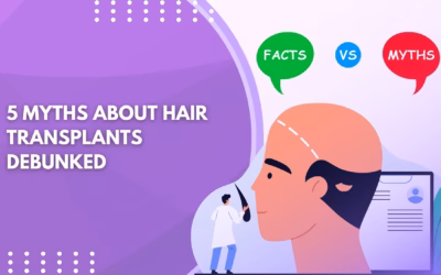 5 Myths About Hair Transplants Debunked