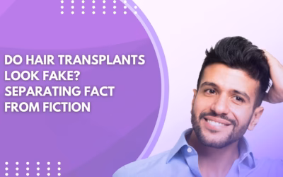 Do Hair Transplants Look Fake? Separating Fact from Fiction