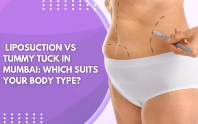 Liposuction vs Tummy Tuck in Mumbai: Which Suits Your Body Type?