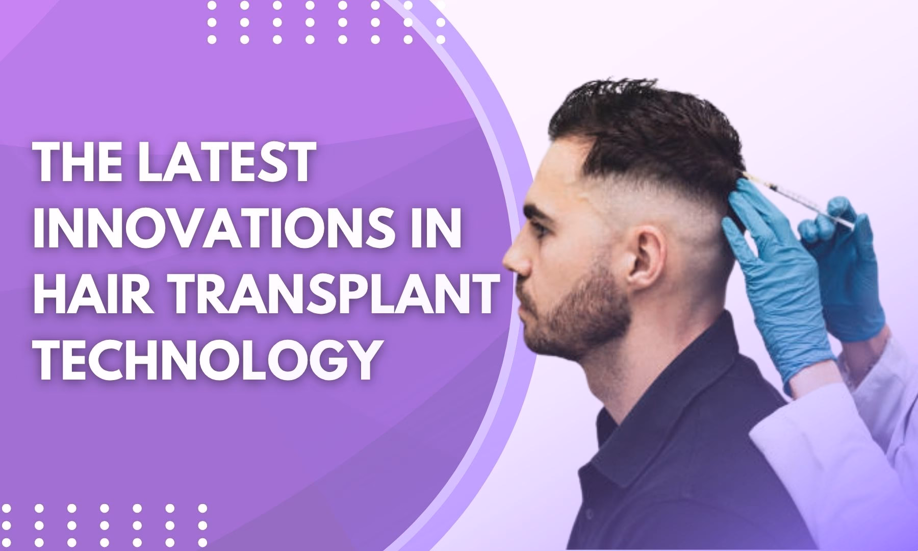 Is Robotic Hair Transplant Better Than Manual NHDT Method?