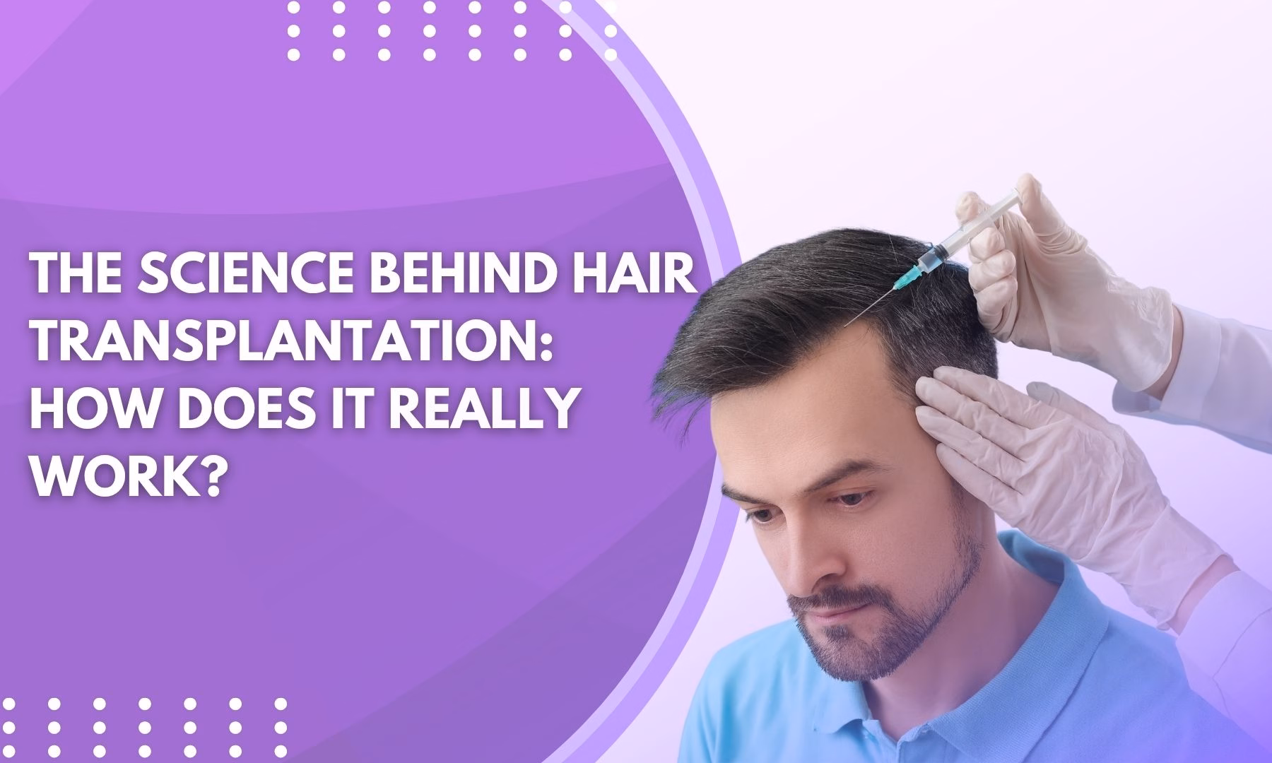 Is Robotic Hair Transplant Better Than Manual NHDT Method?