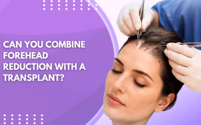 Can You Combine Forehead Reduction With a Transplant?