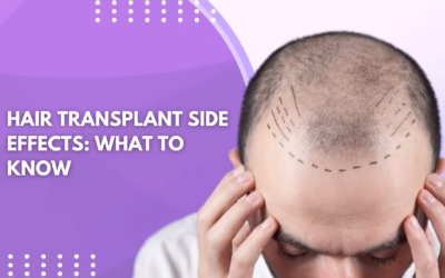 Hair Transplant Side Effects: What to Know