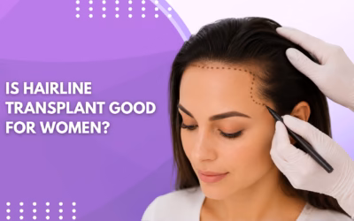 Is Hairline Transplant Good for Women?