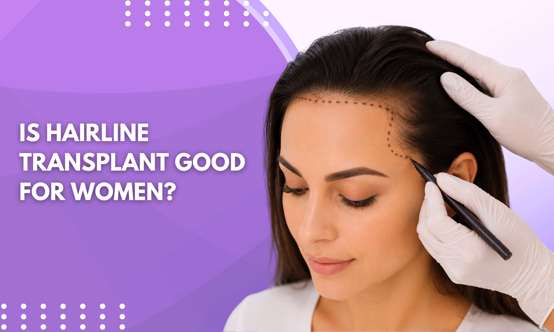 Is hairline transplant good for women