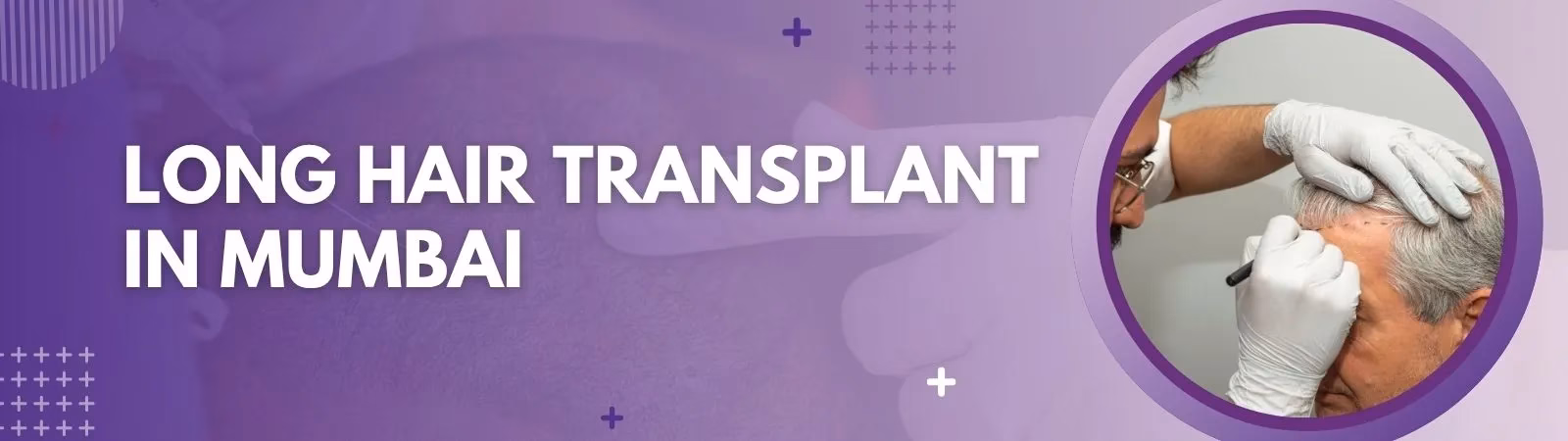 Hair Transplant in Mumbai