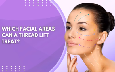 Which Facial Areas Can a Thread Lift Treat?
