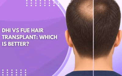 DHI vs FUE Hair Transplant: Which Is Better?