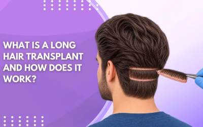 What Is a Long Hair Transplant and How Does It Work?